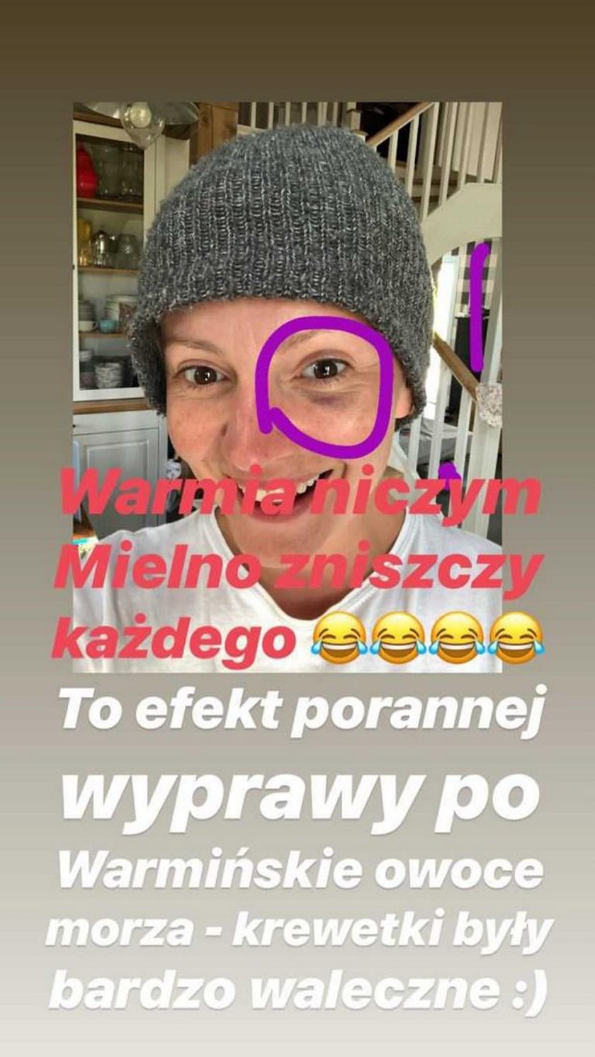 Szelągowska miała wypadek