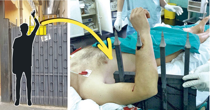 Ne pamti se sličan slučaj: Pripreme u operacionoj sali