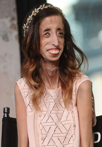 Lizzie Velasquez