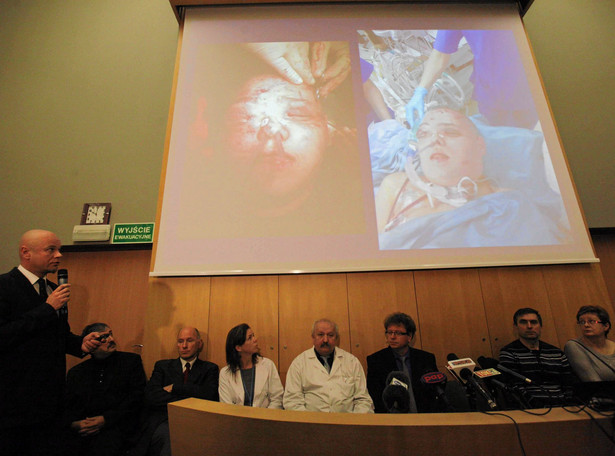 Drugi przeszczep twarzy w Polsce. Operowano dziewczynę z nowotworem