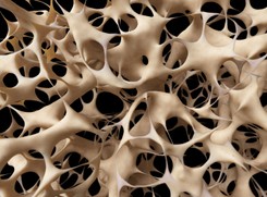 Osteoporoza pod lupą. Wszystko o chorobie