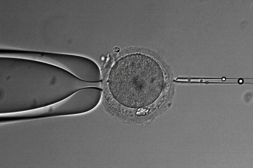 Posłowie przegłosowali ustawę o zapłodnieniu metodą in vitro 