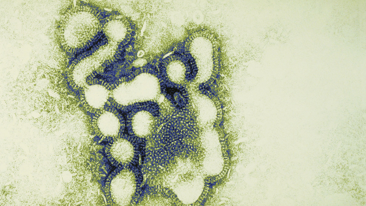 Wymarły wirus grypy, który spowodował największą epidemię w historii, został odtworzony przez amerykańskich naukowców. Eksperyment ma pokazać, jak łatwo mogłoby dziś dojść do pojawienia się podobnego zagrożenia i w ten sposób ułatwić zapobieganie pandemiom. Działanie badaczy wzbudziło jednak ogromne kontrowersje - informuje independent.co.uk.