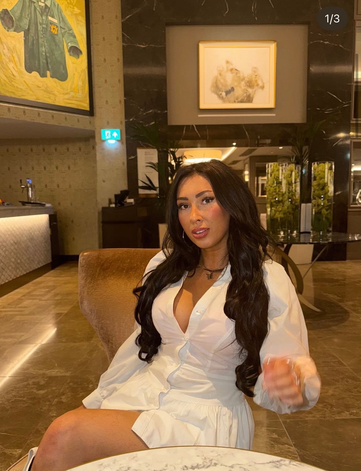 Bežná infekcia sa pre Lauren Carsonovú takmer skončila tragicky.