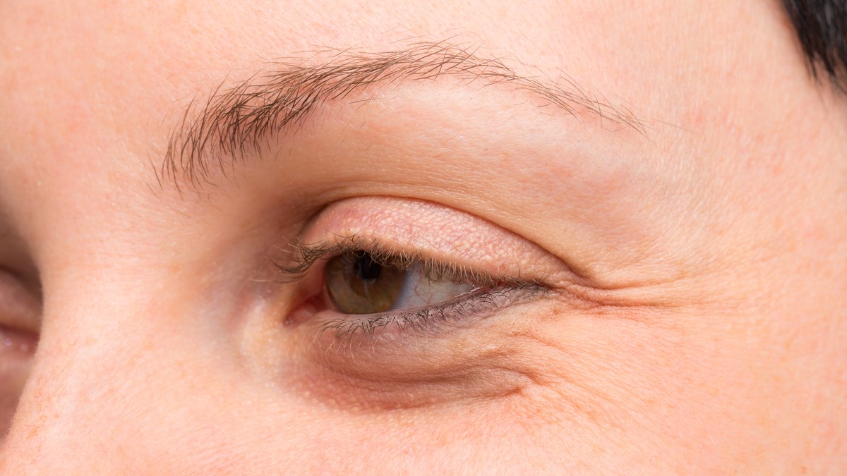 Stručnjaci otkrivaju kako da se rešite podočnjake