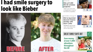 Fan Justina Biebera wydał 100 tysięcy dolarów na operacje, by upodobnić się do idola