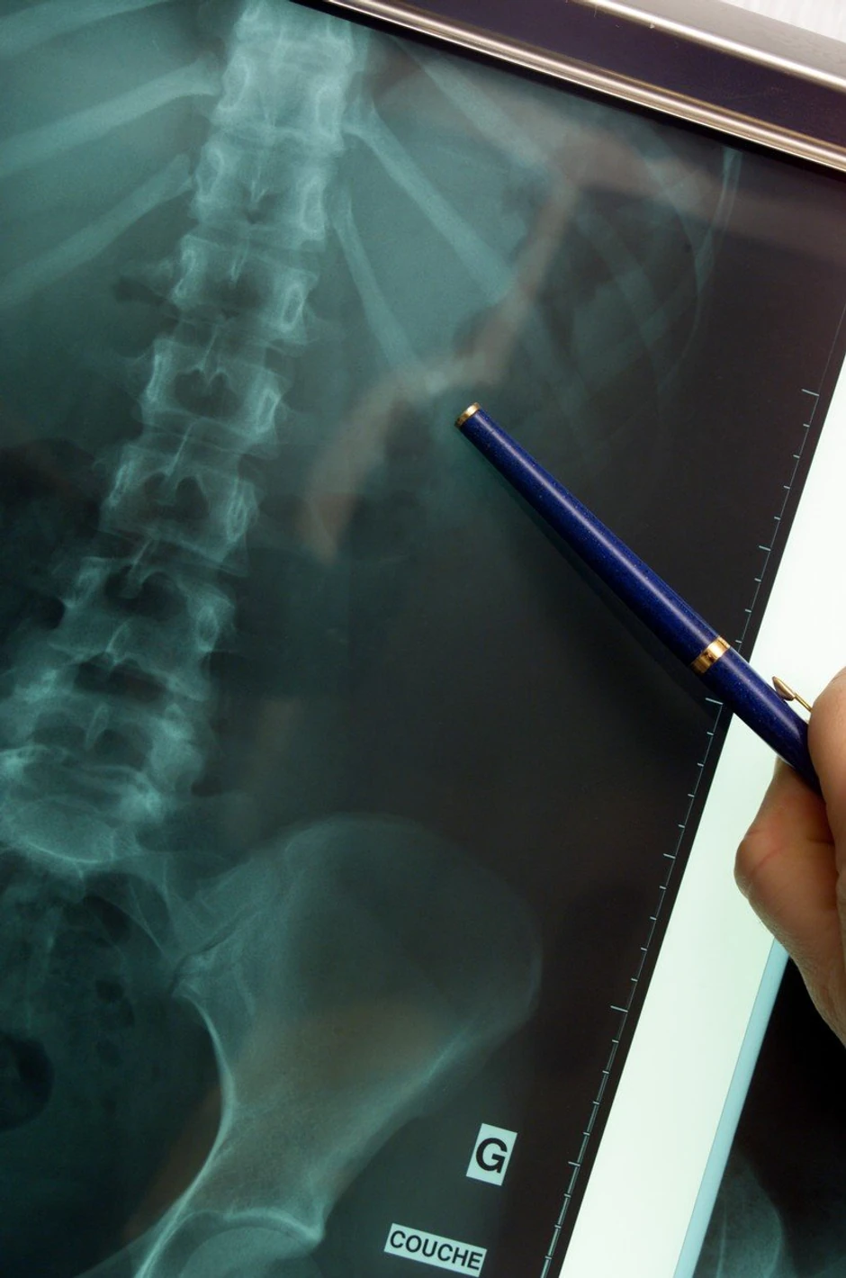 Da je pogledao snimke, hirurg bi uvideo da je u pitanju pelvični bubreg a ne tumor (foto: ilustracija)