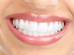 Doskonałość nie jest w modzie: ranking najpiękniejszych uśmiechów