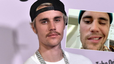 Justin Bieber cierpi na zespół Ramsaya Hunta. Ma sparaliżowane pół twarzy