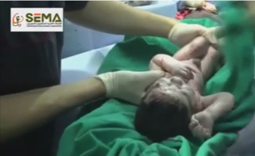 I majka i beba se oporavljaju u bolnici u Siriji