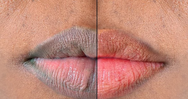5 natural ways to make your lips soft and pink | Pulse Nigeria