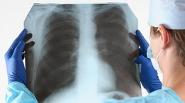Doctor in blue uniform holding X -rays.
