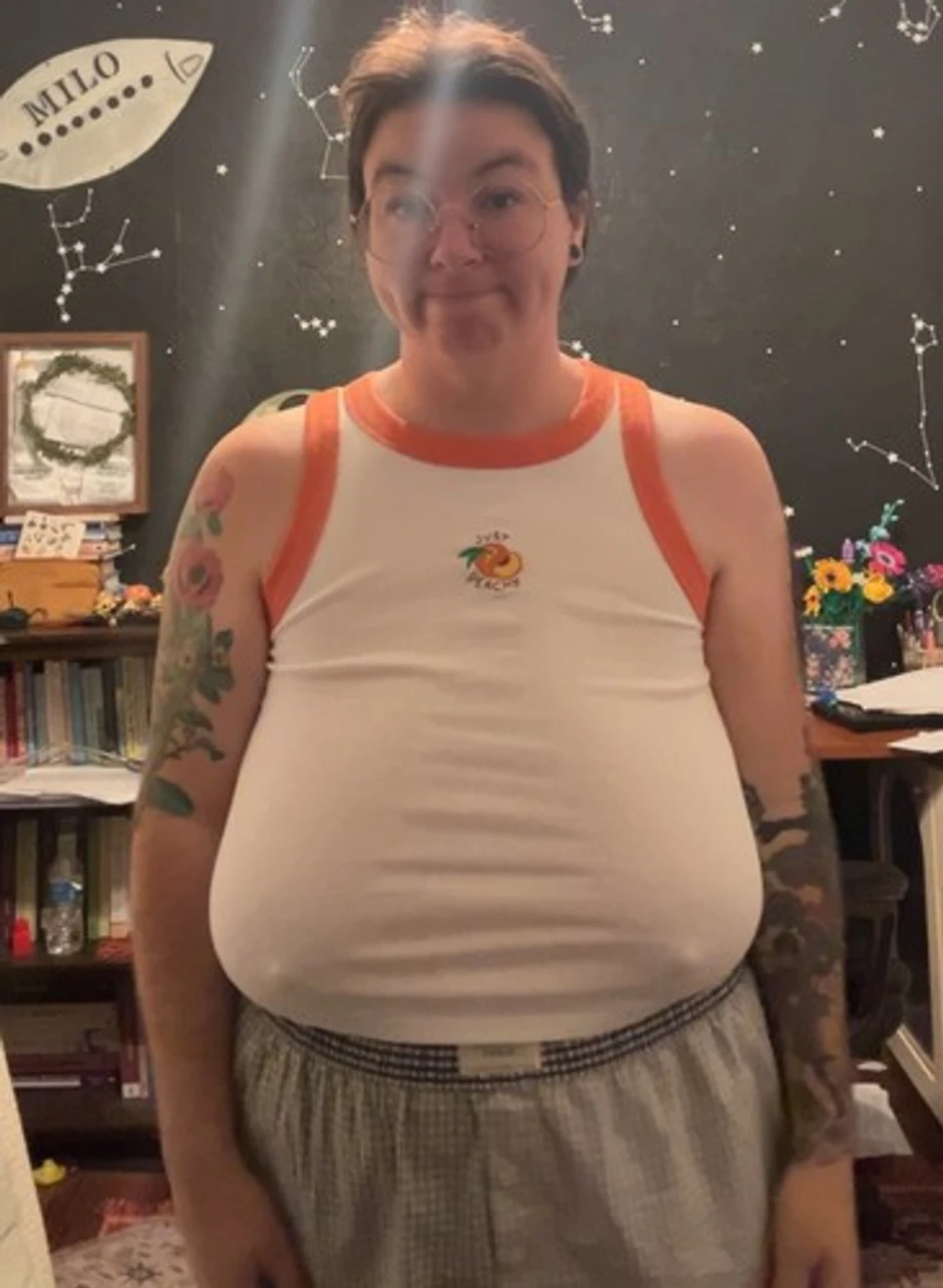 Žena morala da smanji grudi