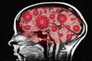 COVID-19 uszkadza układ nerwowy