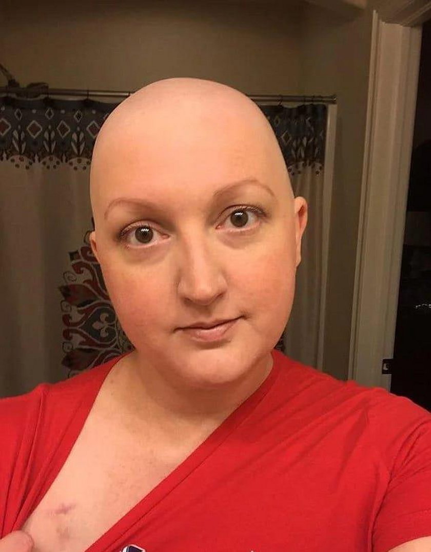 Jerina zmaga się z nowotworem piersi