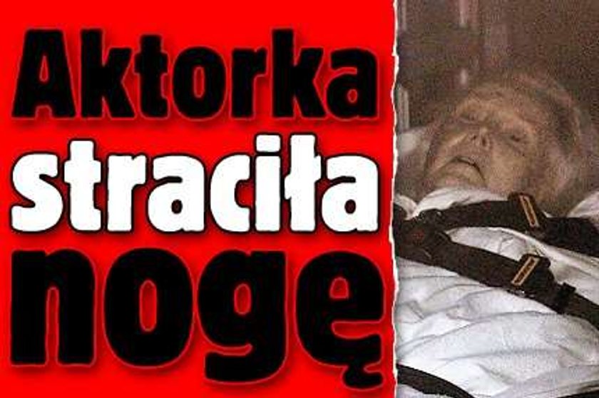 Aktorka straciła nogę