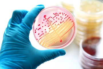 reumás szívbetegség, torokgyulladás, skarlát, gyulladás, antibiotikum, Streptococcus 