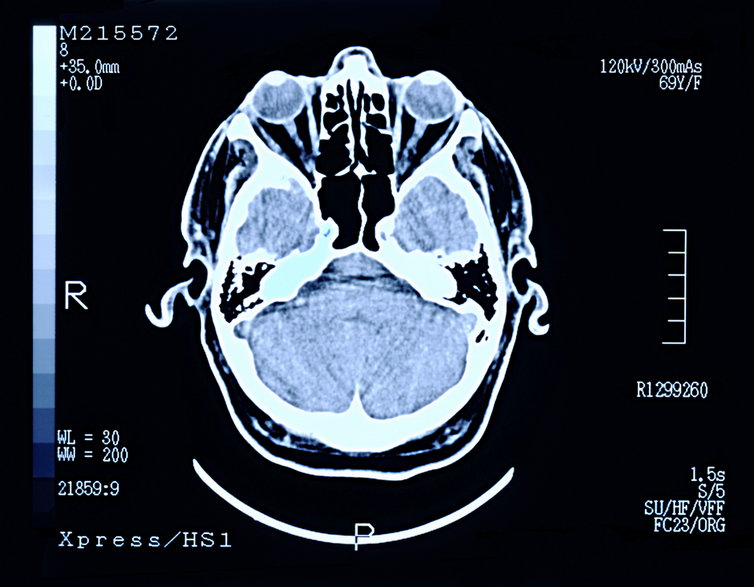 Dzięki nauce badania mózgu są coraz bardziej zaawansowane. / fot. Peter Dazeley/Getty Images