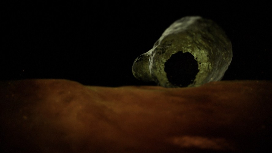 Naegleria fowleri - powoduje poważne uszkodzenie mózgu, często prowadzące do śmierci. Zarażenie następuje często na basenie, kiedy w czasie pływania pierwotniak dostaje się wraz z wodą do nosa