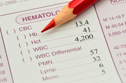 Mit jelent a hematokrit (Htc) érték a laborleleten?