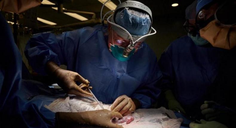 Le rein d’un porc génétiquement modifié continue à fonctionner 32 jours après sa transplantation sur un humain en état de mort cérébrale. - Photo AFP