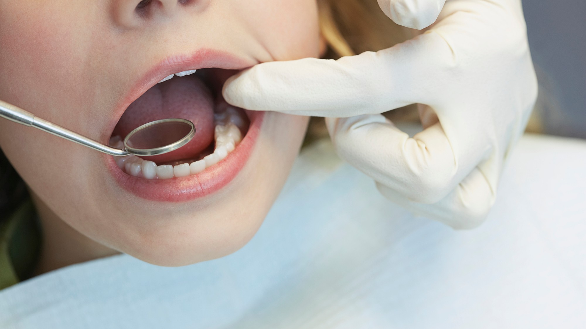 Afty sú časté najmä pri strese, oslabení imunity či počas zimy (ilustračné foto).