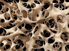 Prawie 30 proc. Polek cierpi na osteoporozę. Co trzeba wiedzieć o chorobie?