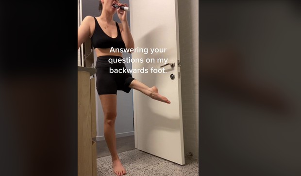 Devojka sa obrnutim stopalom