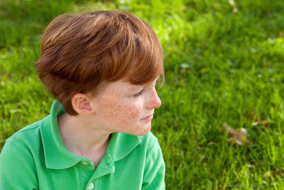 Rengetegen csúfolták a szeplői miatt Fotó: iStock