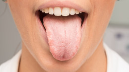 Zdrowy język ma różowy kolor i równe kształty