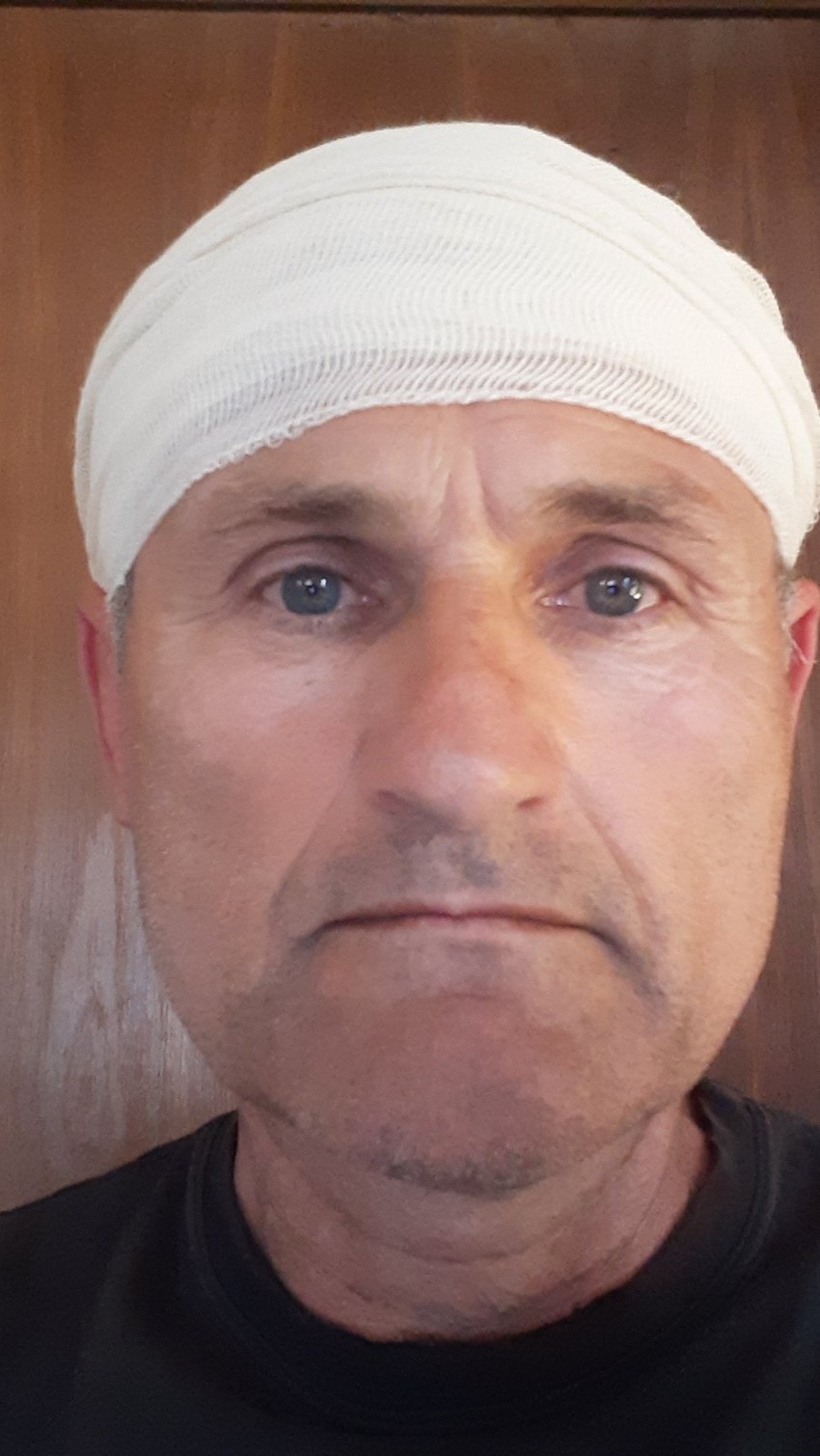 Đorđe Ašić napadnut je sekirom u glavu