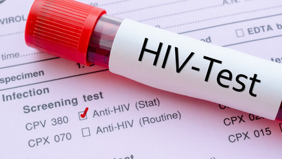 Rohamosan terjed a HIV-vírus Magyarországon!