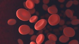 Anemia sierpowata: dziedziczna, nieuleczalna, śmiertelna