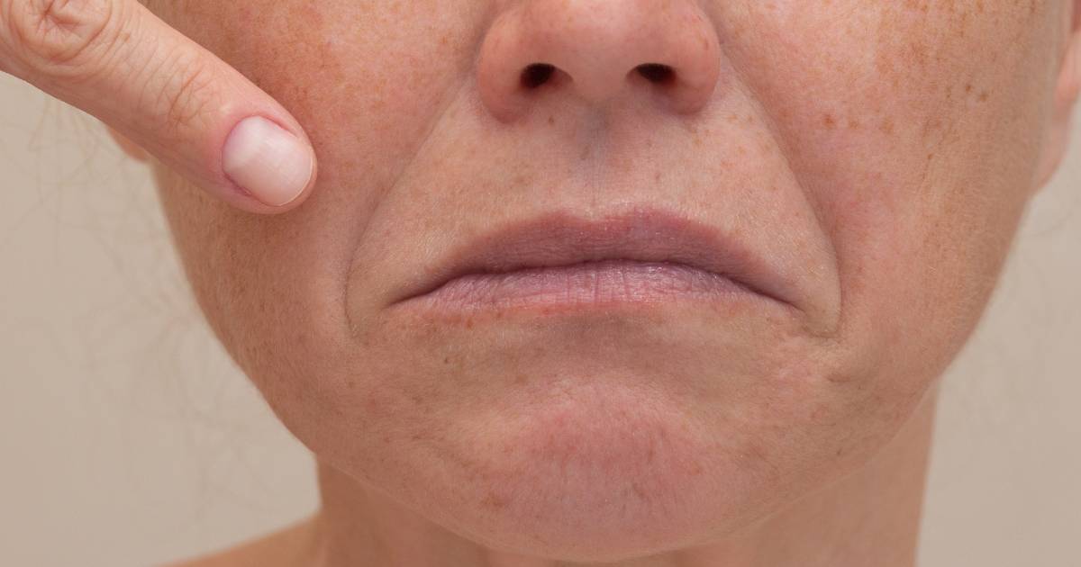 Pozbądź się chomików! To serum podnosi policzki jak botoks, teraz taniej o 50 procent