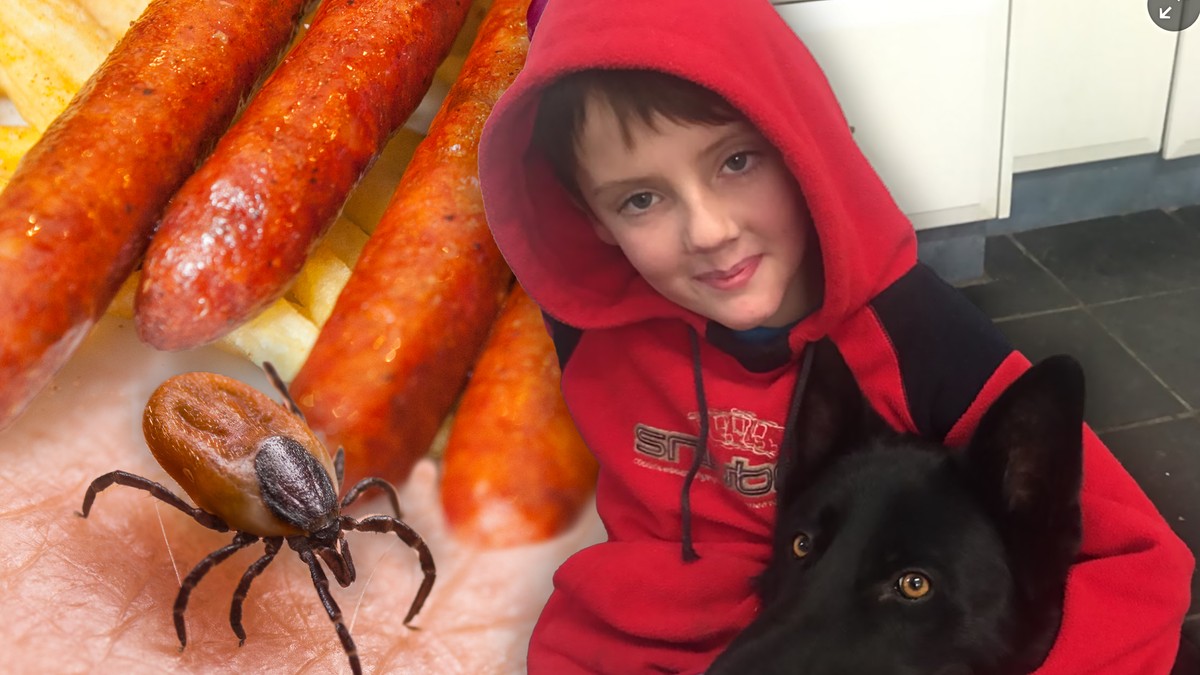 Tinejdžer preminuo od alergija na meso izazvane ubodom krpelja 