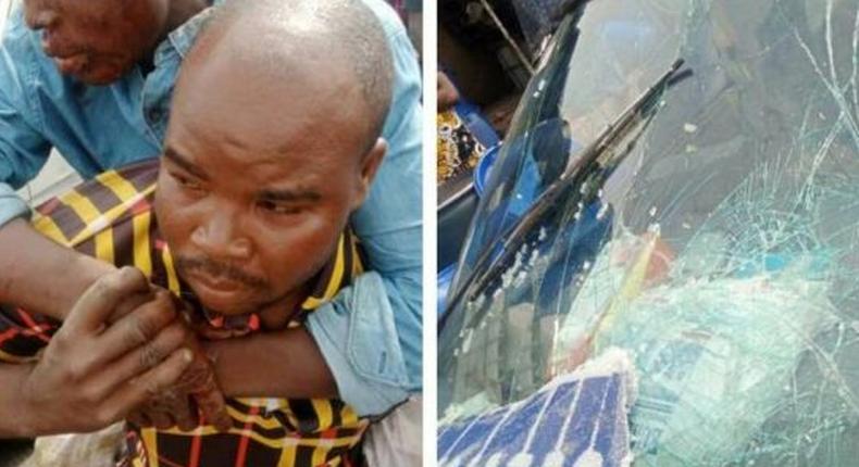 A picture of one side of one of the  accident victims at Adeniji Adele area of Lagos. [PM News]