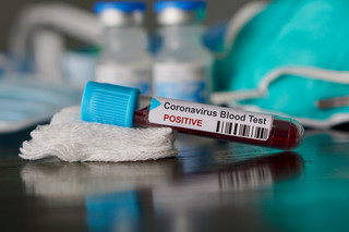 MZ: 2,4 tys. osób hospitalizowanych z powodu koronawirusa, ponad 1000 wyzdrowiało