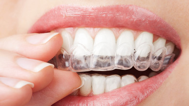 Domowe metody wybielania zębów nie zawsze są bezpieczne