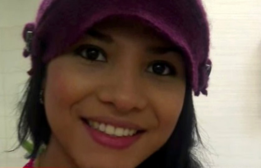 Angie Mendoza Cera umarła po operacji plastycznej