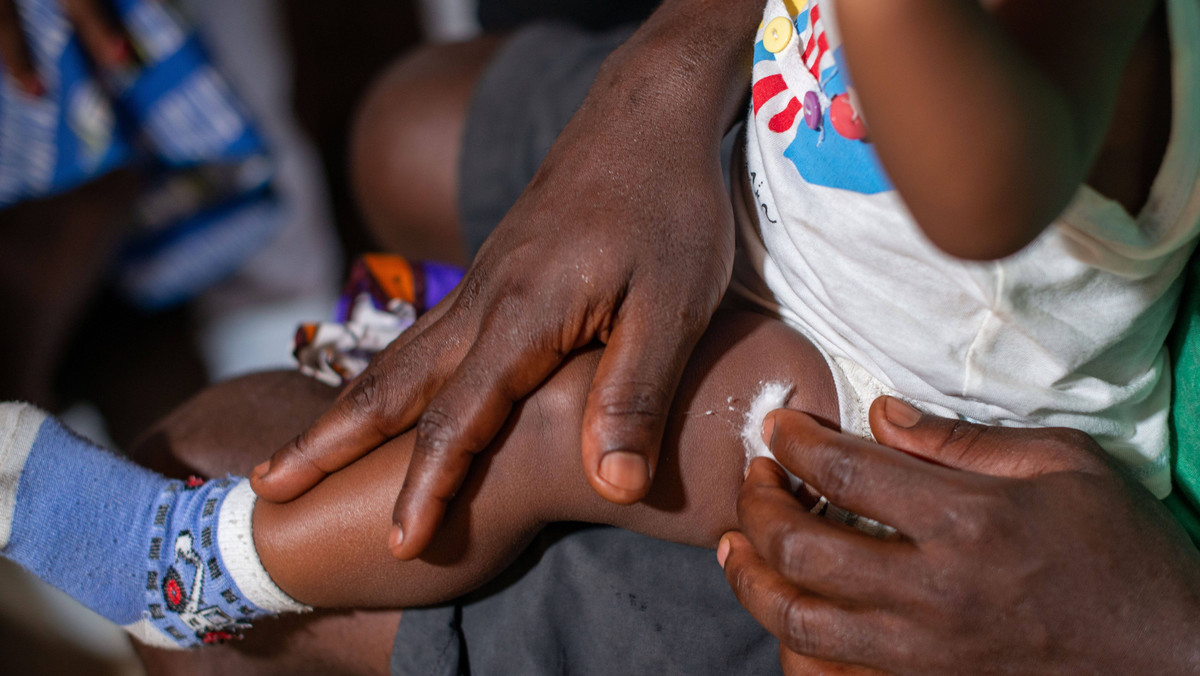Pierwszy na świecie program szczepień przeciwko malarii dla dzieci rusza w Kamerunie