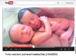 Bliźniaki jeszcze się nie zorientowały, że już się urodziły [WIDEO]