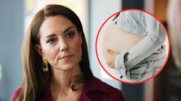 W ciąży chorowała jak Kate Middleton. Wymiotowała 40 razy w ciągu doby