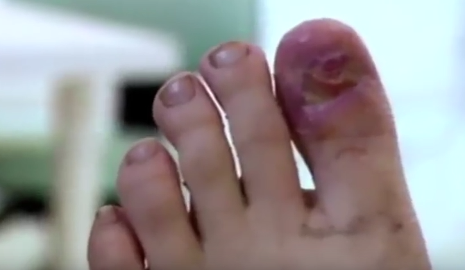 Posle operacije situacija je bila ovakva