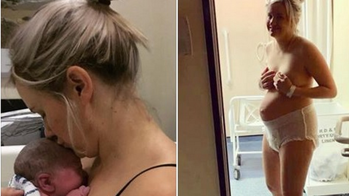 Kilka dni temu w mediach społecznościowych pojawiło się zdjęcie kobiety w pieluszce dla dorosłych. Młoda kobieta chciała pokazać wszystkim, jak naprawdę wygląda ciało po porodzie.