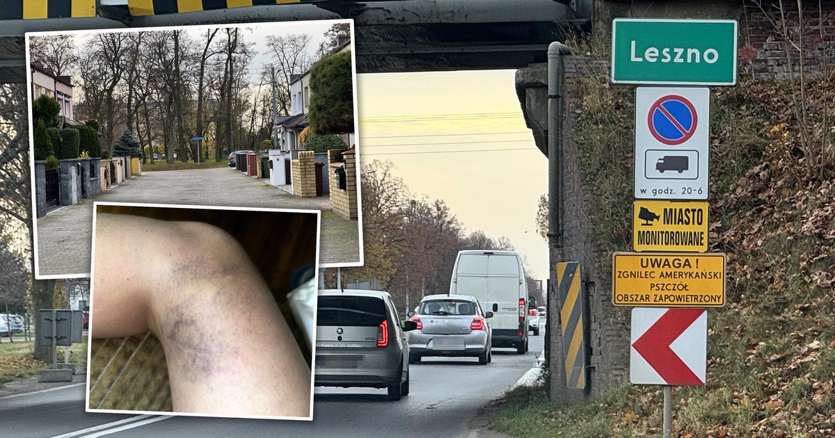 Nastolatek pobił taksówkarkę z Ukrainy. "To dzieciak z porządnej ulicy"