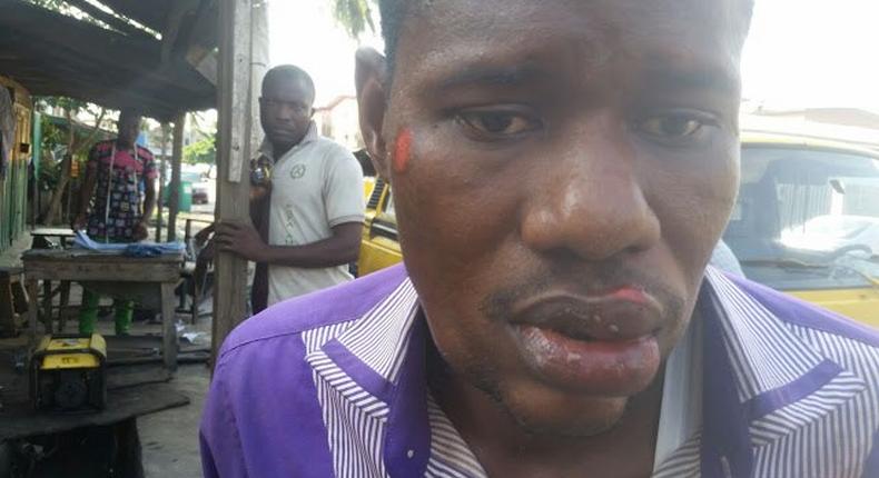 Unidentified man beaten up by LASTMA officials