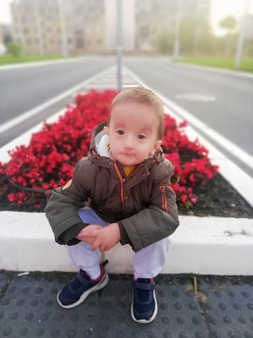 Dečak Luka koji je gluvonem i ima paralizu polovine lica