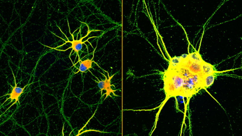 Na zdjęciu obrazy fluorescencyjne ludzkich neuronów (zabarwionych na czerwono, zielono i niebiesko) rosnących na powłokach z szybko poruszającymi się cząsteczkami (po lewej) lub konwencjonalną lamininą (po prawej) przez 60 dni, fot. Northwestern University