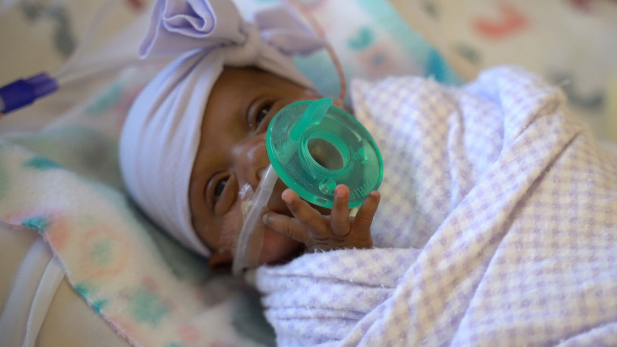 W szpitalu w San Diego przyszło na świat najmniejsze dziecko w dziejach