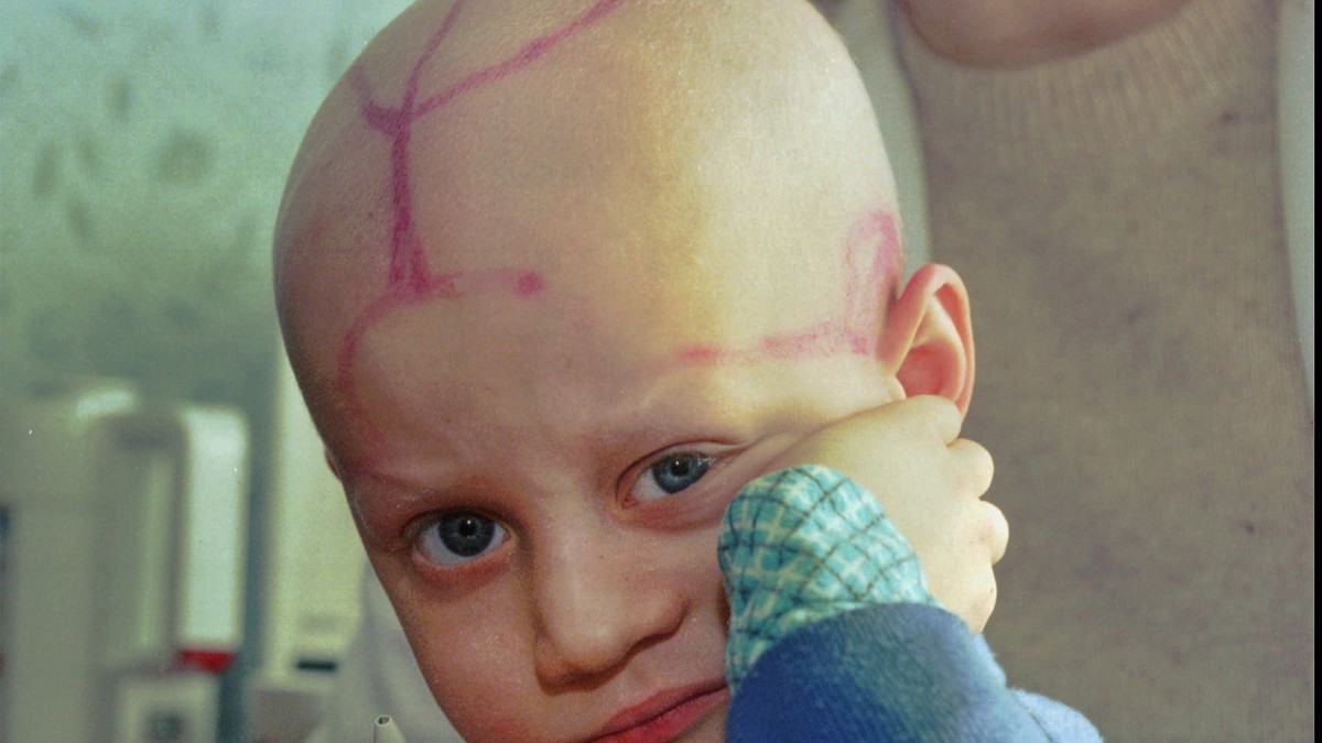 Alek Žloba sedi na dečjem odeljenju za rak sa oznakama koje su mu lekari napravili na glavi nakon hemoterapije u Gomelu, Belorusija, 19. marta 1996. godine, skoro 10 godina nakon eksplozije i požara u nuklearnoj elektrani Černobilj